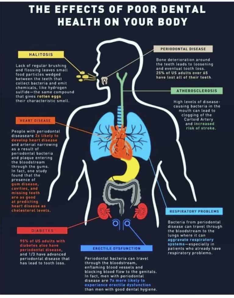 Overall Oral Health In Houma, LA | Sevier Dental