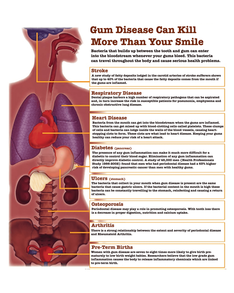 Overall Oral Health In Houma, LA | Sevier Dental